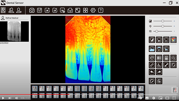 Dental Sensor Automatic Adjustment